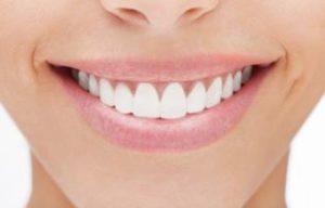 Healthy, bright, and beautiful teeth | Cosmetic Dentistry in LA