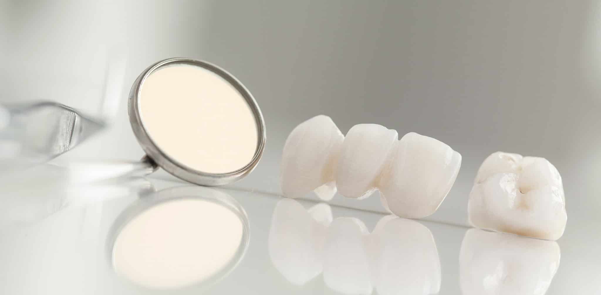 Dental Restoration New Orleans Exceptional Dental of LA