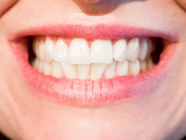 metairie orthodontics personalized, metairie orthodontist