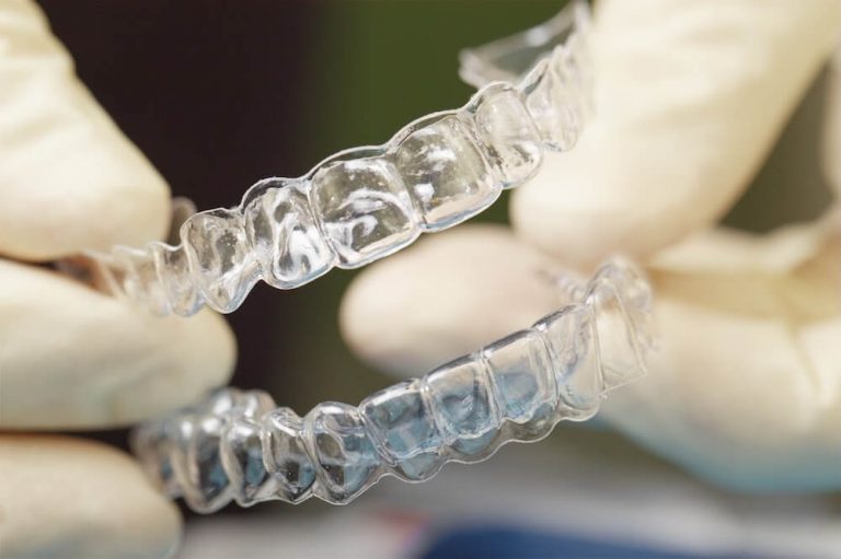 Clear aligners, representing the cosmetic services offered by Exceptional Dental.